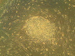 Колония эмбриональных стволовых клеток человека