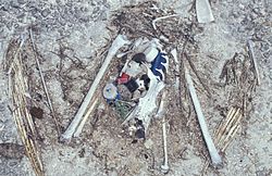 Resterna av denna kyckling av Laysan albatross visar den plast som den fick i sig innan den dog, bland annat en flaskkapsel och en tändare.  