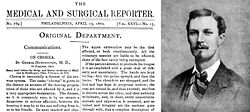 In 1872 beschreef George Huntington op 22-jarige leeftijd de aandoening in zijn eerste artikel "On Chorea".  
