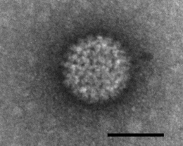 Bluetongue virus under the electron microscope. The marking corresponds to 50 nm