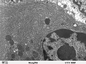 Micrographie électronique du réseau de réticulum endoplasmique rugueux autour du noyau (en bas à droite de l'image). Les petits cercles sombres du réseau sont des mitochondries.
