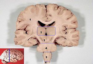 Inimese aju sellel lõigul on tähistatud keskmine aju, pons ja piklik ajukest (medulla oblongata).