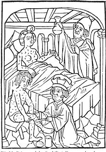 Gambar medis paling awal yang diketahui tentang penderita sifilis, dari Wina (1498)