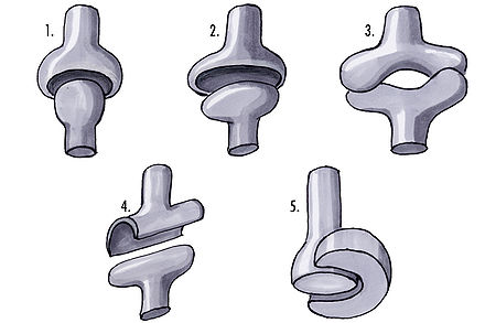 Real joints: 1-ball joint; 2-egg joint; 3-saddle joint; 4-hinge joint; 5-pivot joint.