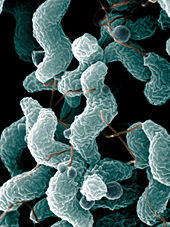 Campylobacter, ein Bakterium, das eine Hauptursache für Lebensmittelvergiftungen ist.