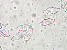 Verschillende Diatomeeënsoorten hebben harde schelpen met veel verschillende vormen en patronen. De schelpen blijven ook na hun dood bestaan en zijn nuttig voor de palynologie.  