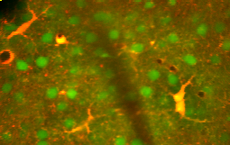 Astrocitai (raudonai geltona) tarp neuronų (žalia) gyvoje smegenų žievėje