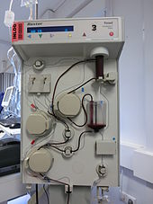 Plasmapheresis device