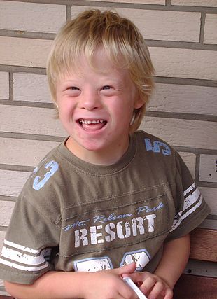 Um menino de oito anos com síndrome de Down