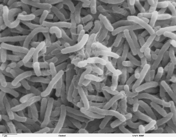 Skanowanie pod mikroskopem elektronowym obrazu bakterii wywołujących chorobę cholery.