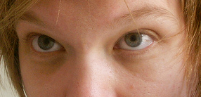 Mindre mørke rande og en antydning af øjenposer, en kombination, der tyder på mindre søvnmangel.  