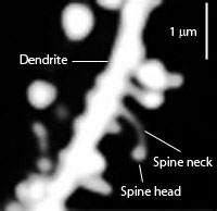 Dendrite with several spines ( dendritic spines )