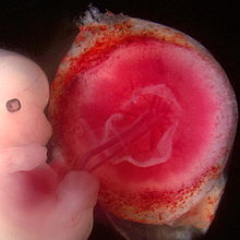 Human placenta with fetus