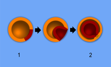 Gastrulación de un diploblasto: La formación de capas germinales desde una (1) esfera de células (la blástula) hasta una (2) gástrula. Algunas de las células del ectodermo (naranja) se desplazan hacia el interior formando el endodermo (rojo).