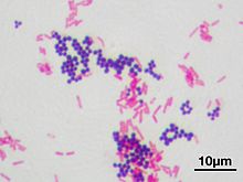 Gramovo barvení smíšených grampozitivních koků Staphylococcus aureus (fialově) a gramnegativních bacilů Escherichia coli (červeně).