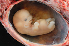 Tak wygląda ludzki embrion około osiem tygodni po zapłodnieniu