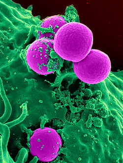 Rastrovací elektronový mikrofotografický snímek lidského neutrofilu požitého MRSA (umělá barviva)