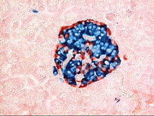 Islets of Langerhans of the pancreas (insulin marked in blue and glucagon in red. The diameter of the islet is 0.2 to 0.5 mm).