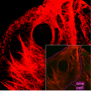 Mikroskopia filamentów keratynowych wewnątrz komórek.