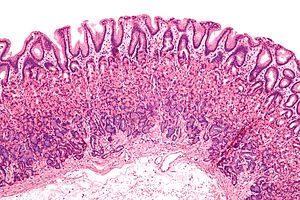 Microscopic preparation of normal gastric mucosa