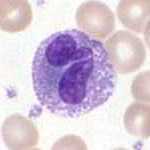 Eosinofila granulocyter  