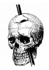 Phineas Gage's ulykke  