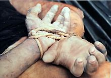 在美国佛罗里达州，人的手在水下数天后腐烂。