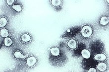 Micrografie electronică de transmisie a coronavirusului OC43 cultivat în organe  