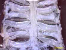 Luftröhrensystem einer Kakerlake. Die größten Luftröhren verlaufen über die Breite des Körpers und sind in diesem Bild horizontal. Maßstabsbalken: 2 mm